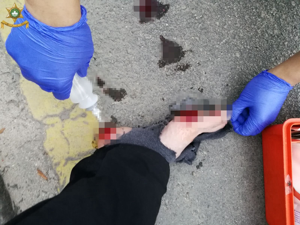 事件導致警員多處受傷02